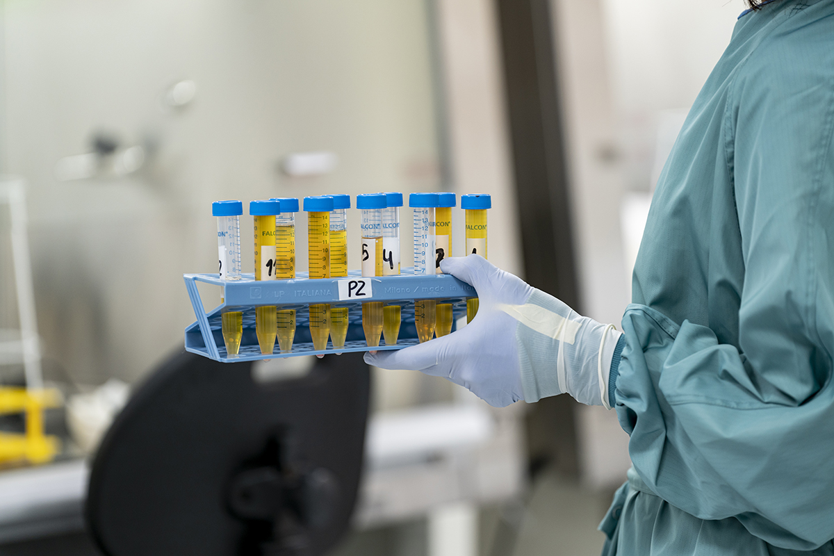 Situació actual de la COVID-19 persistent a Catalunya. On ens trobem?