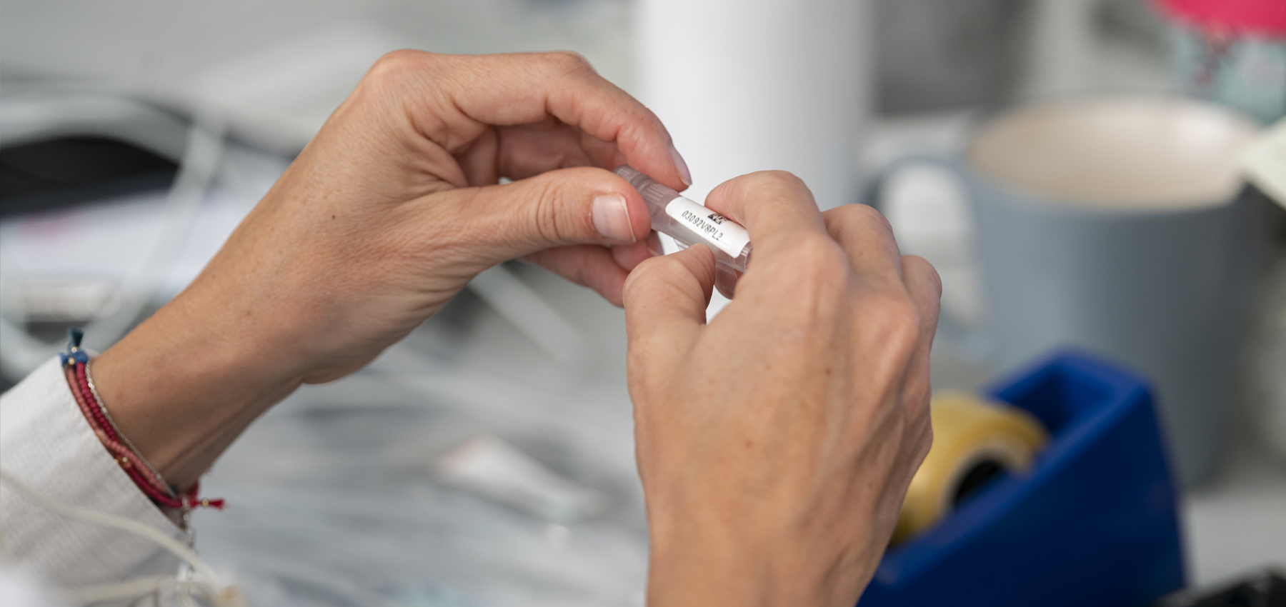 1 de diciembre, Día Mundial de la Lucha contra el Sida