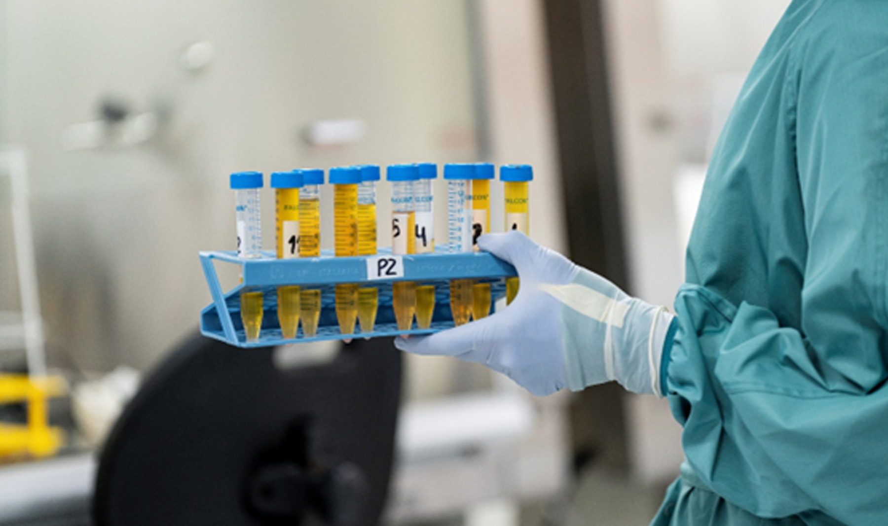 Iniciamos el ensayo clínico Thalassa para luchar contra el COVID persistente